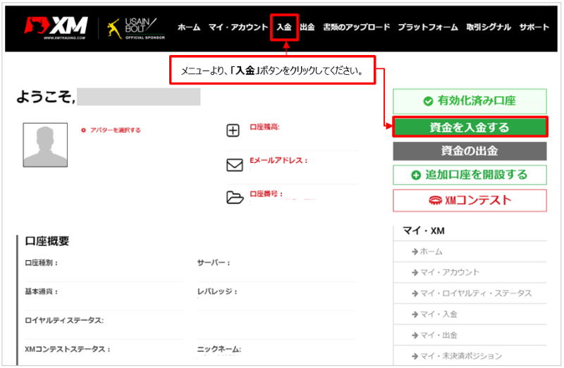 XM
